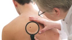 Person being checked for skin cancers.