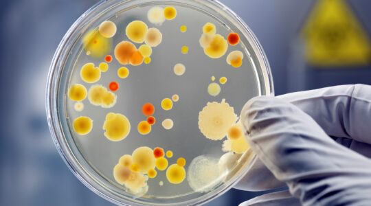 Bacteria in Petrie dish. | Newsreel