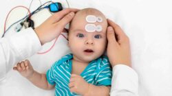 Baby on EEG monitor. | Newsreel