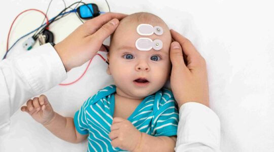 Baby on EEG monitor. | Newsreel