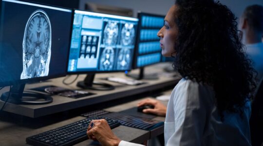 Doctor looking at brain scans. | Newsreel