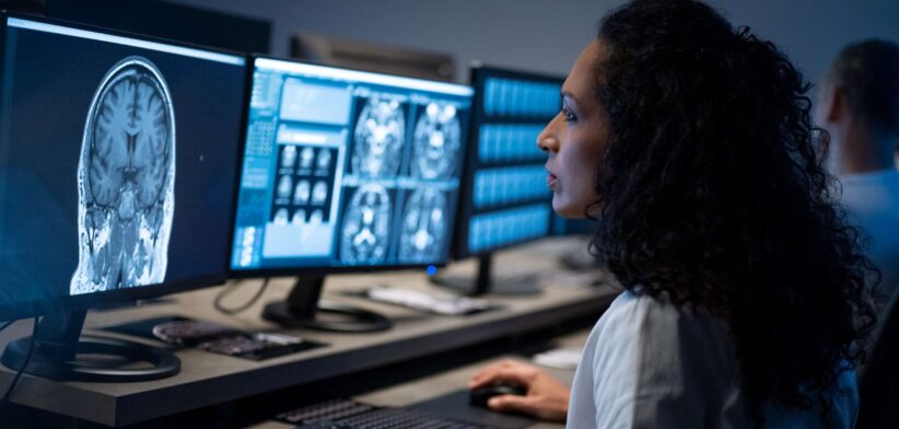 Doctor looking at brain scans. | Newsreel