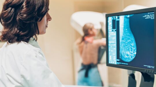 Bid to lift breast screening rates as numbers grow