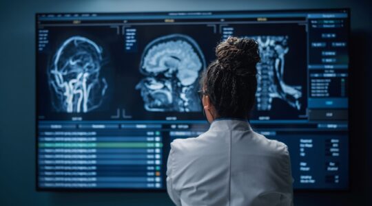 Doctor looking at brain scan. | Newsreel