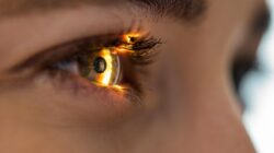 Close up of woman's eye. | Newsreel