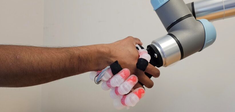 New robotic prosthetic, John Hopkins University. | Newsreel