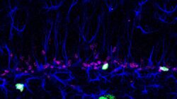 Brain Cells. | Newsreel
