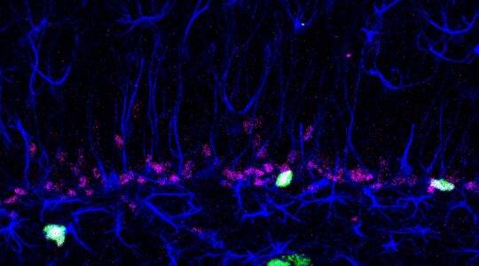 QIMR breakthrough to target ‘sleeping’ brain cancer cells