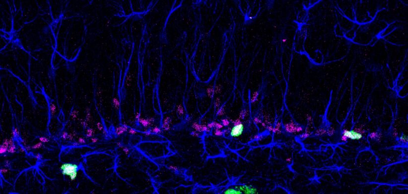 Brain Cells. | Newsreel