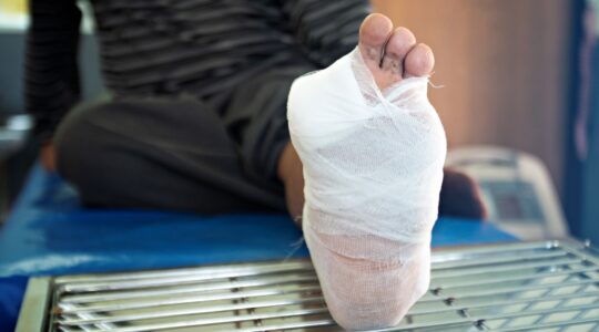 Australian amputation rates in young males increasing
