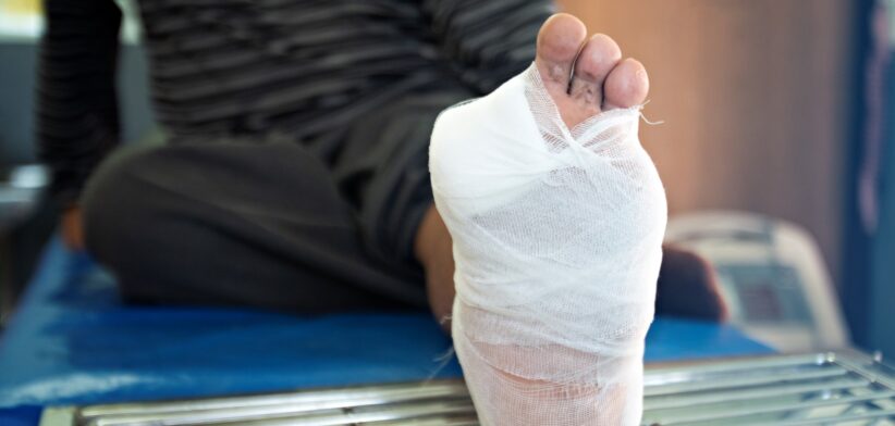 Toes amputated. | Newsreel