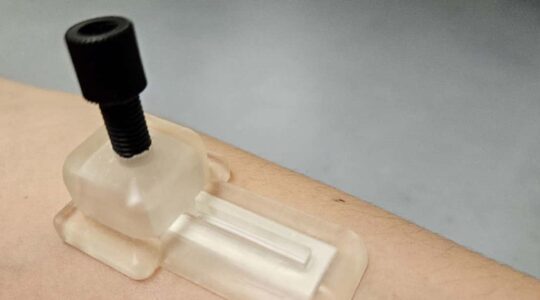 Self-powered microneedle patch. | Newsreel