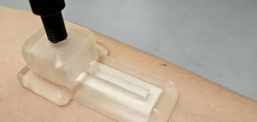 Self-powered microneedle patch. | Newsreel