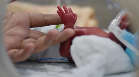 Premature baby. | Newsreel